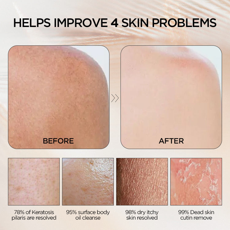 Exfoliating Gloves Mitten Remove Dead Skin Bath Body Scrub