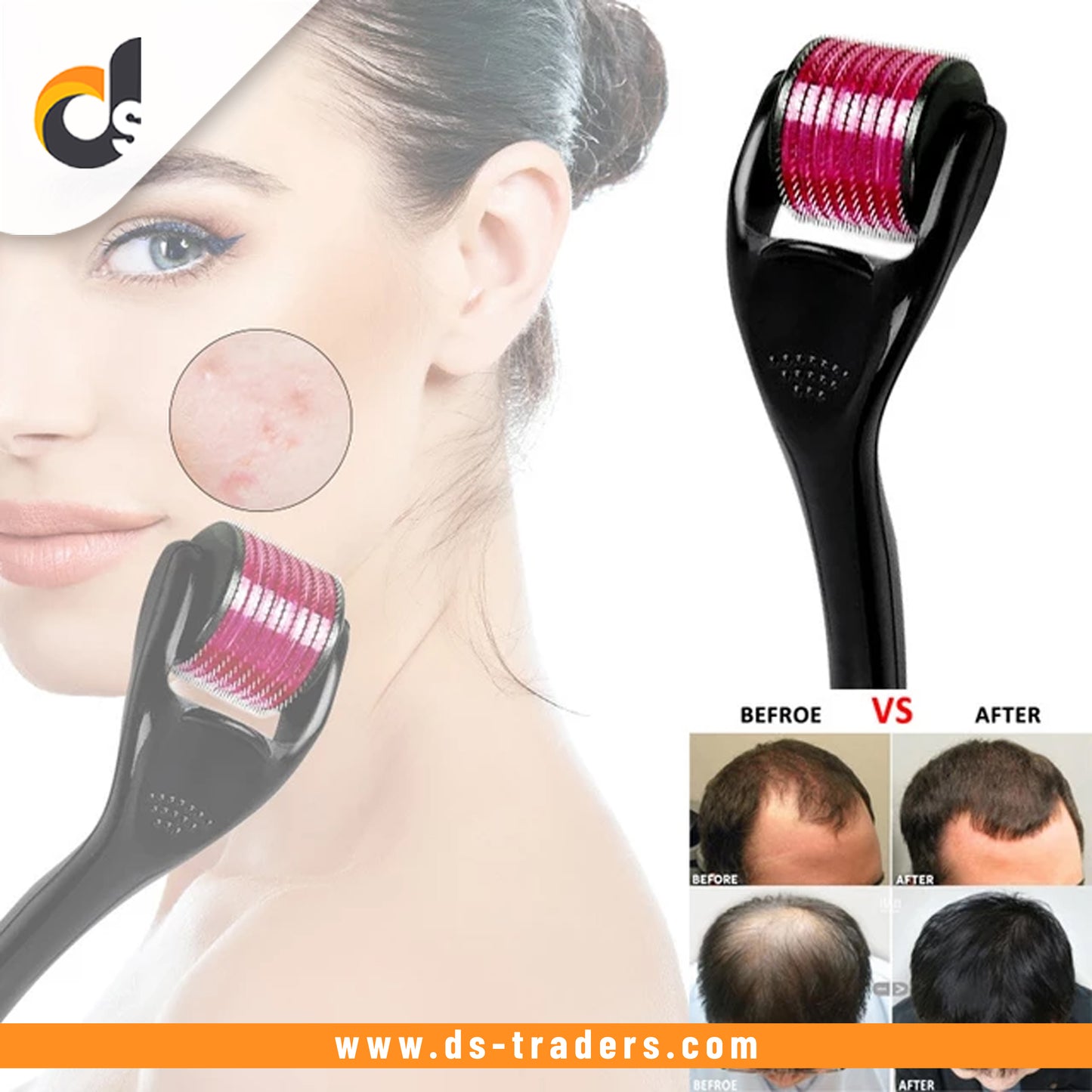 Micro Needle 540 Roller Derma Roller Anti Hair Loss Treatment.