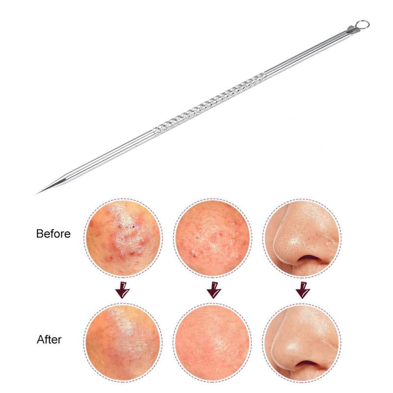 Pack OF 2-Stainless Steel Pimple Extractor Blackhead Pimples Pin Acne Remover.