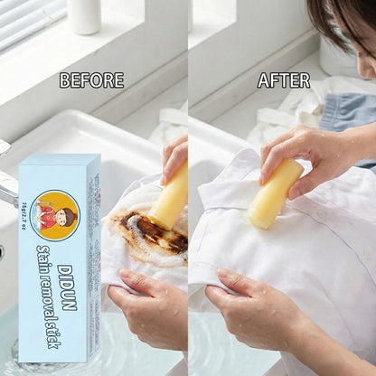 Magic Stain Remover Laundry Soap
